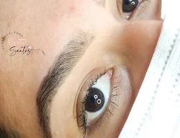 Renata Santos | Remoção a laser de tatuagem e micropigmentação