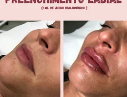 ESTÉTICA HARMONIZE MANDAGUAÇU